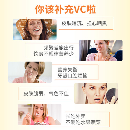 300片康恩贝维生素c咀嚼片VC片维他命复合b族甜橙维c男女天然ve 300片康恩贝维生素c咀嚼片VC片维他命复合b族甜橙维c男女天然ve