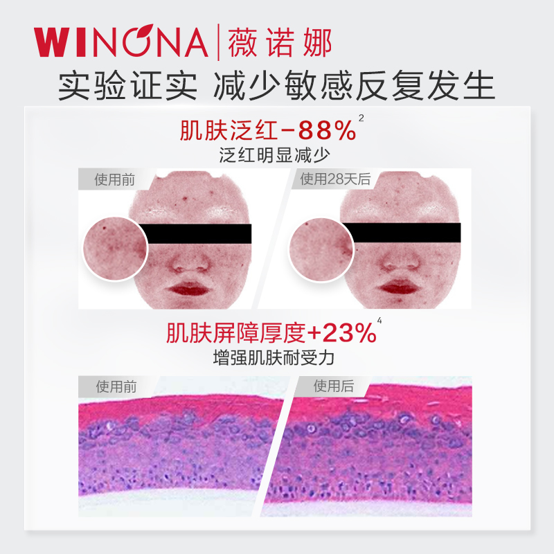 【会员尝鲜派样】第二代薇诺娜特护霜5g 敏感肌补水舒缓保湿修护