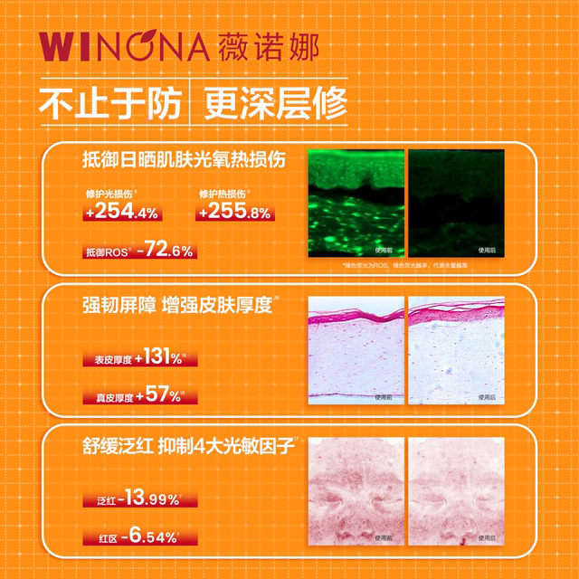Winona Clear Sunscreen Lotion ຜ່ອນຄາຍ, ບາງເບົາແລະອ່ອນໆ