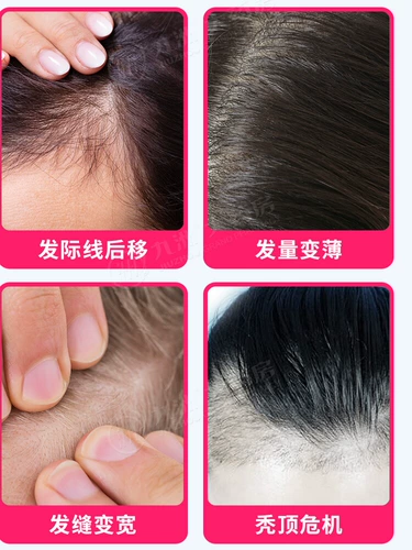 达霏欣 Mino di Labonite 60 мл/30 мл раствора 2% мужская выпадение волос Алопеция АРЕЦИЯ ЖЕНЩИНА ГОЛОВА