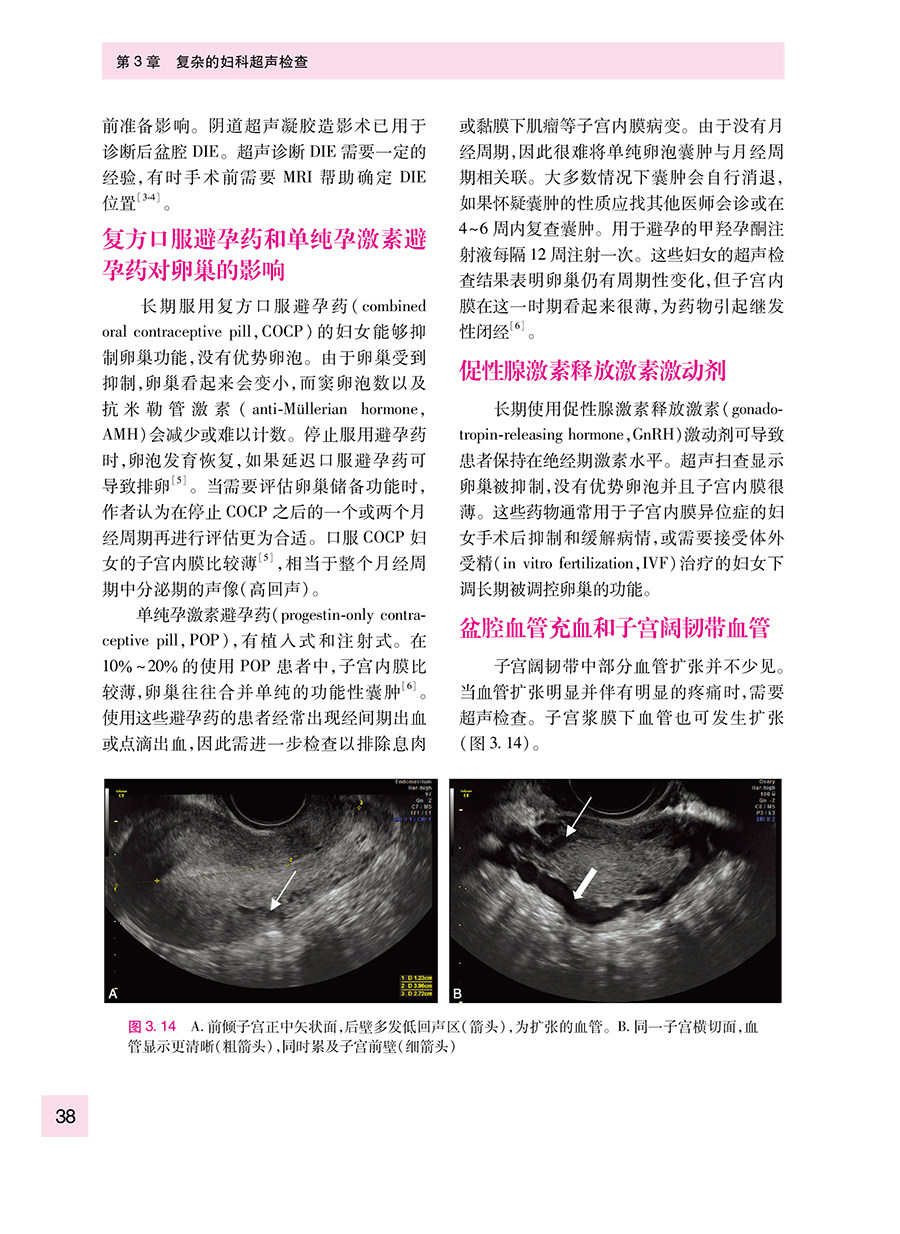 妇科超声检查要点与技巧 黄瑛主译 妇科超声先进技术超声设备报告书写 超声扫查技术疾病诊断 影像学 人民卫生出版社
