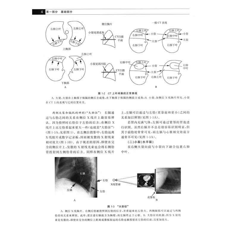 胸部影像学肺和心血管放射学第3版徐妍妍主译胸膜异常气道病变先天性心脏病大动脉临床影像书籍河南科学技术出版社9787572511394 - 图1