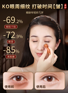 【古法美容】纯黄铜小莲蓬眼部按摩器眼周面部拨筋棒提拉朱雀三啄
