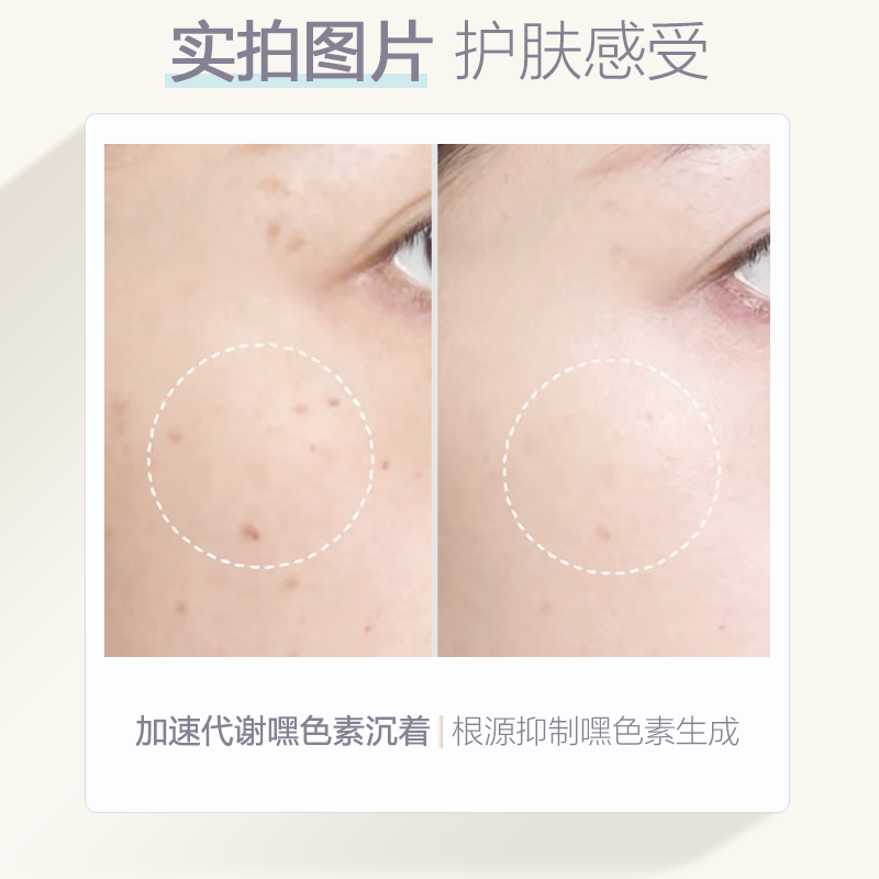 olay玉兰油第二代淡斑小白瓶精华烟酰胺美白色淡林淡痘印prox小样,淘宝优惠券,粉丝福利购,淘宝优惠卷