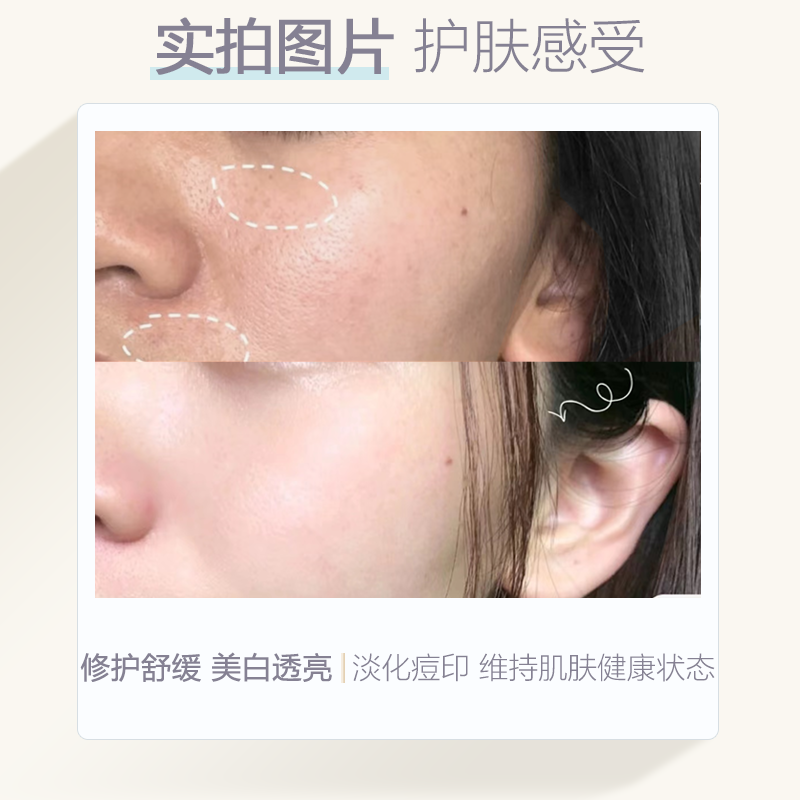 olay玉兰油第二代淡斑小白瓶精华烟酰胺美白色淡林淡痘印prox小样,淘宝优惠券,粉丝福利购,淘宝优惠卷