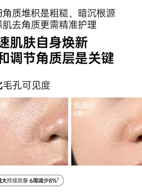 60%酵母水保湿修护细毛孔去角质闭口湿敷水抗氧提亮焕肤精华水