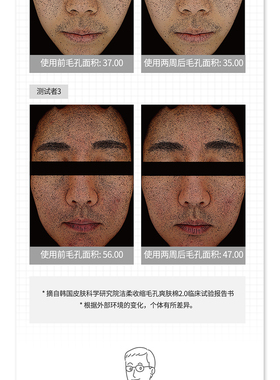 韩国收缩毛孔Medicube