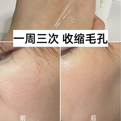 南非AMC芦荟胶膏去闭口痘印Aloe Gel补水保湿过敏晒后修护99%学生 - 图0