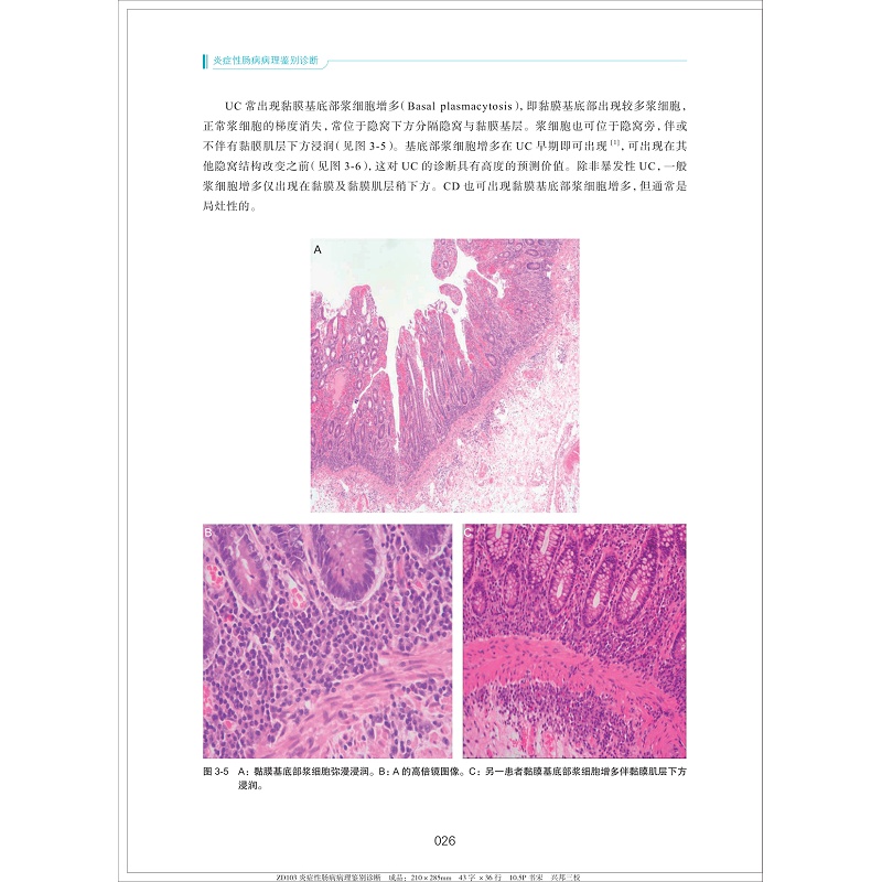 炎症性肠病病理鉴别诊断(精)/炎症性肠病诊断与治疗丛书/肖书渊/姜支农/刘秀丽/浙江大学出版社 - 图2