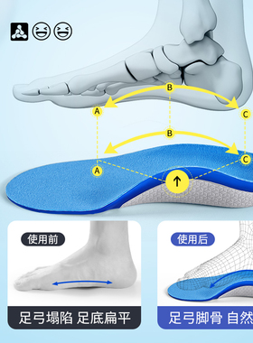 JvBV儿童足弓矫正鞋垫支撑