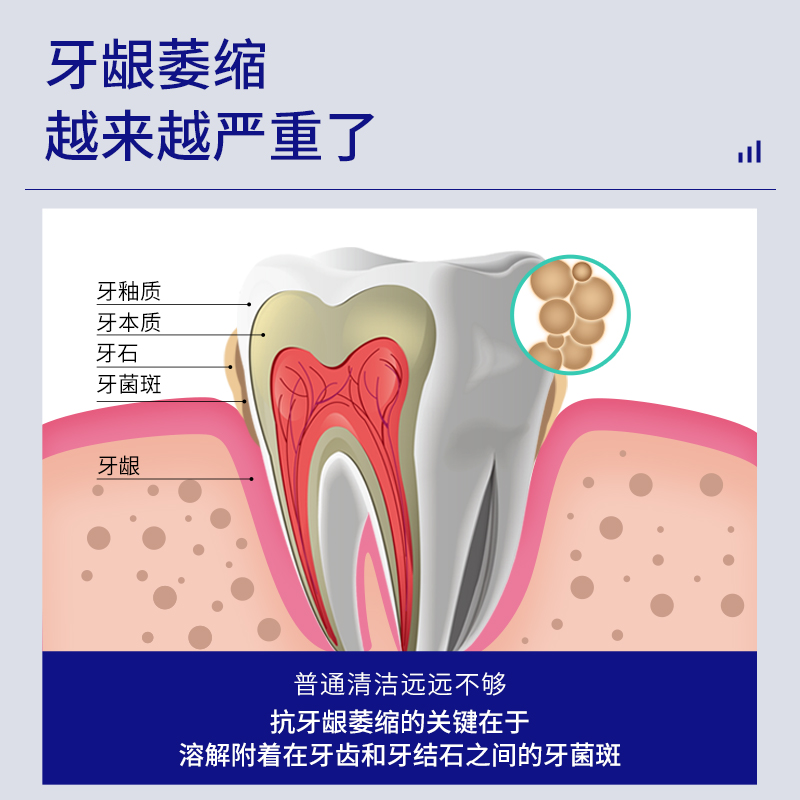 牙龈萎缩修复再生专用牙膏医用口腔护理牙周炎牙齿松动口腔脱敏膏-图1