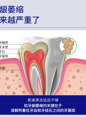 初医生牙龈萎缩修复再生牙周牙膏