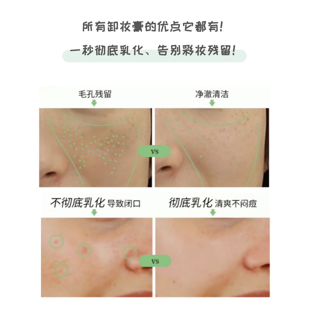 Farmacy/法沫溪辣木籽卸妆膏清洁温和不闷敏感肌眼唇乳化20ml*3 - 图3