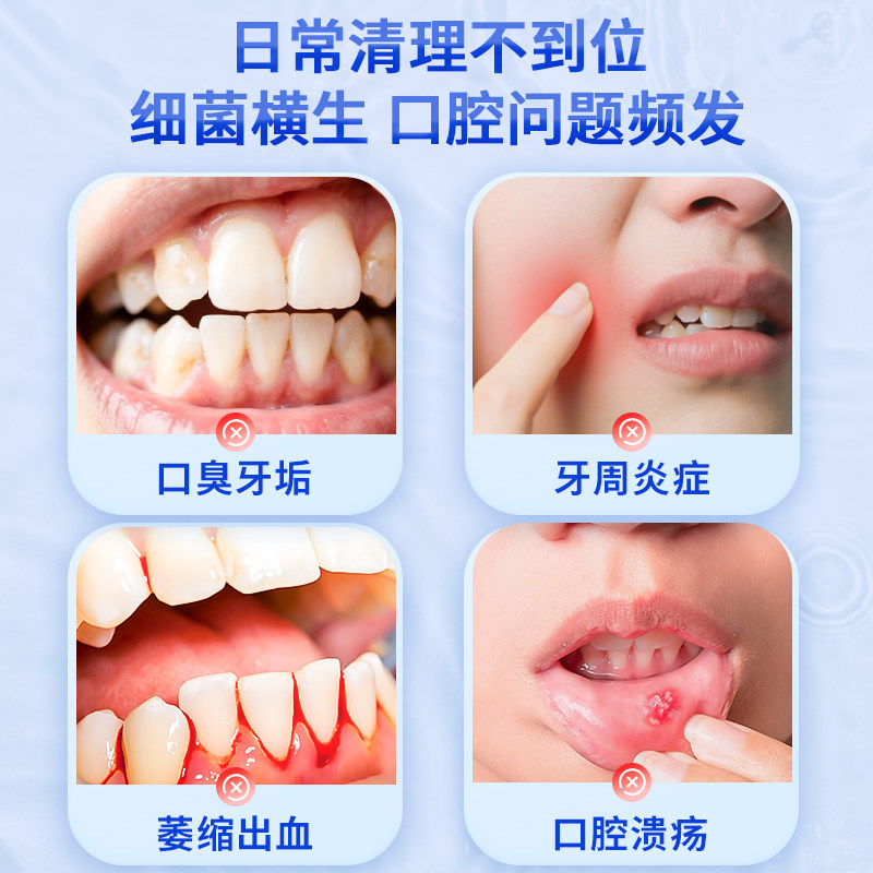 医用漱口水牙周炎症专用杀菌消炎消肿缓解口腔溃疡红肿痛持久留香,淘宝优惠券,粉丝福利购,淘宝优惠卷