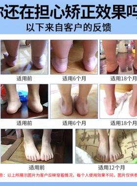 足印部落儿童鞋垫扁平足足弓支撑