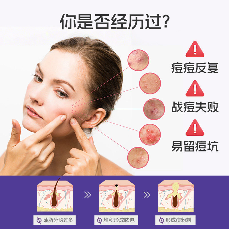 痘痘贴医用快速日夜双效隔绝污染轻薄隐形遮瑕可上妆水胶体敷料,淘宝优惠券,粉丝福利购,淘宝优惠卷