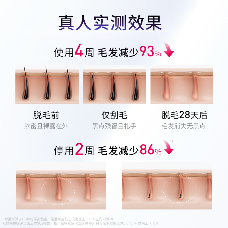 【百亿秒杀节】Ulike冰点脱毛仪A3星黛粉1件腋下唇毛全身长效-图1