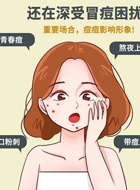 FREELIN芙雷琳星星痘痘贴遮瑕祛痘贴可上妆抗痘贴轻薄透气日夜用