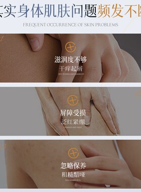 凡士林身体乳止痒干燥保湿滋润女皮肤儿童修复屏障正品官方直销店