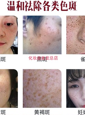 台湾正品liliki亮丽快日霜靓丽快日霜911靓丽快早霜快速祛黄