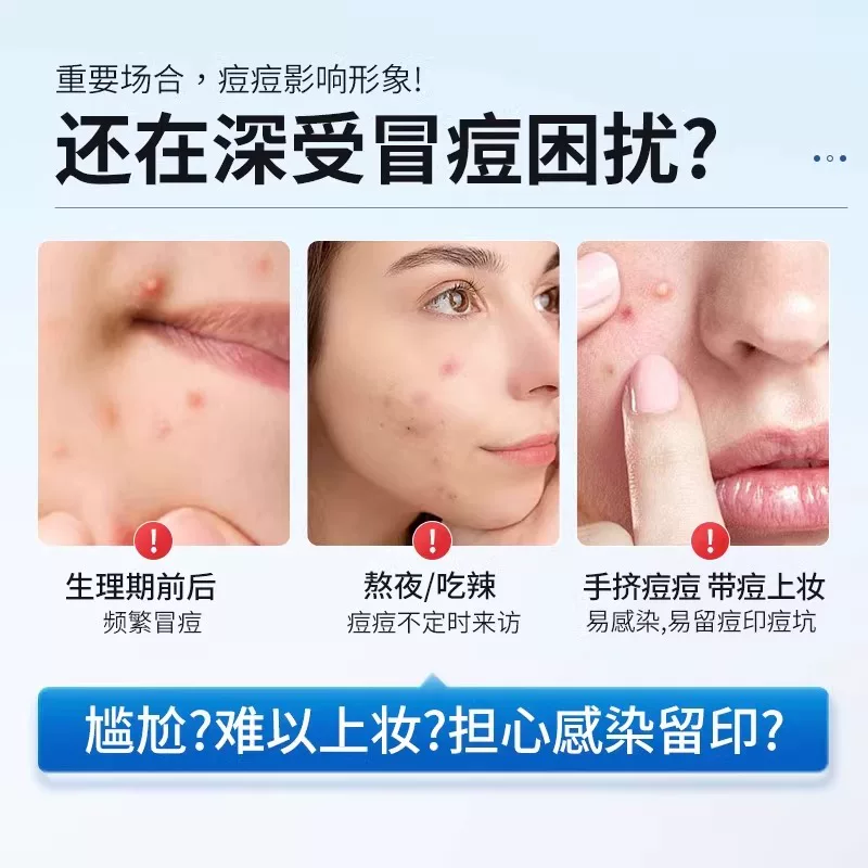 П patches для acne, милая основа, скрывает акне, против акне
