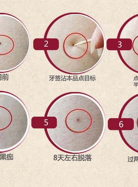 点斑水雀斑水取痣膏去黑点神器痦子脸部黑痣痦子无痕正品美容金水