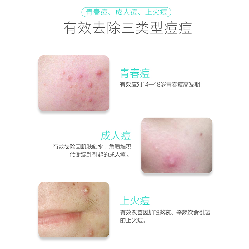丽普司肽旗舰店暨大医药中心祛痘凝露 男女士青春痘祛痘印膏淡痘印凹洞痘坑产品1