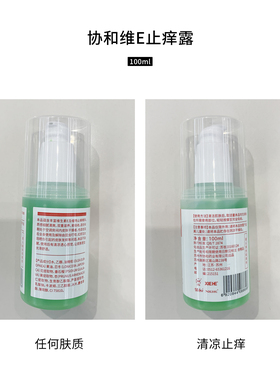 协和正品维E止痒露e乳薄荷清凉凝露保湿快速止痒修复蚊虫叮咬官网