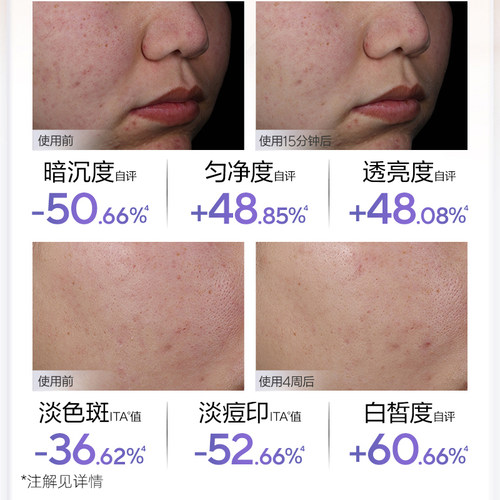 欧诗漫美白淡斑面膜去补水保湿黄气暗沉女提亮肤色官方旗舰店正品 - 图2