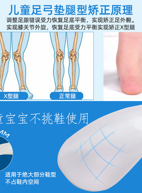 宝宝走路姿势足心垫足弓矫正器