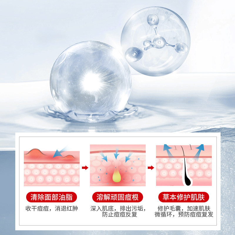 瓷肌30ml女士持久净颜祛痘精华液 瓷肌液态精华