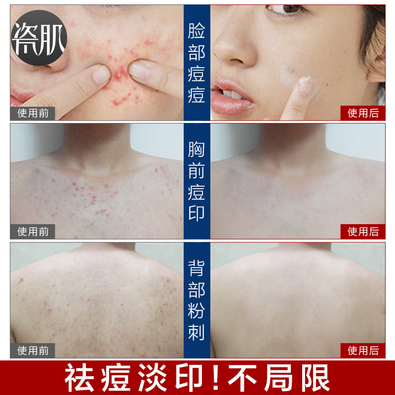 瓷肌清洁收缩毛孔控油洁面乳洗面奶 瓷肌洁面