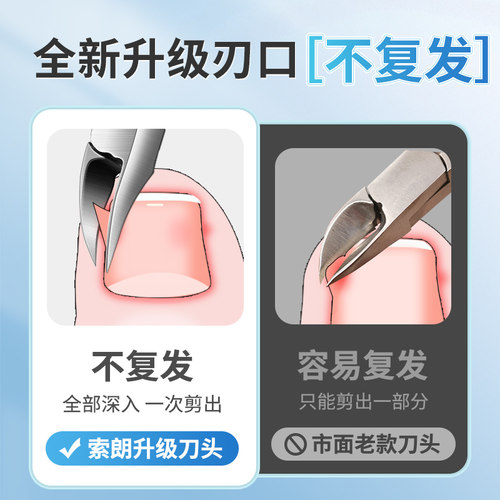 甲沟专用钳指甲刀指工具套装剪刀修脚神器脚趾甲鹰嘴尖嘴甲勾剪炎 - 图2