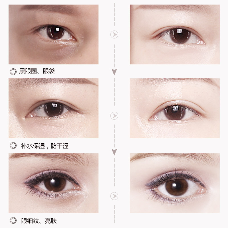 玛茜烟酰胺抗皱去细纹补水学生眼霜 玛茜眼霜