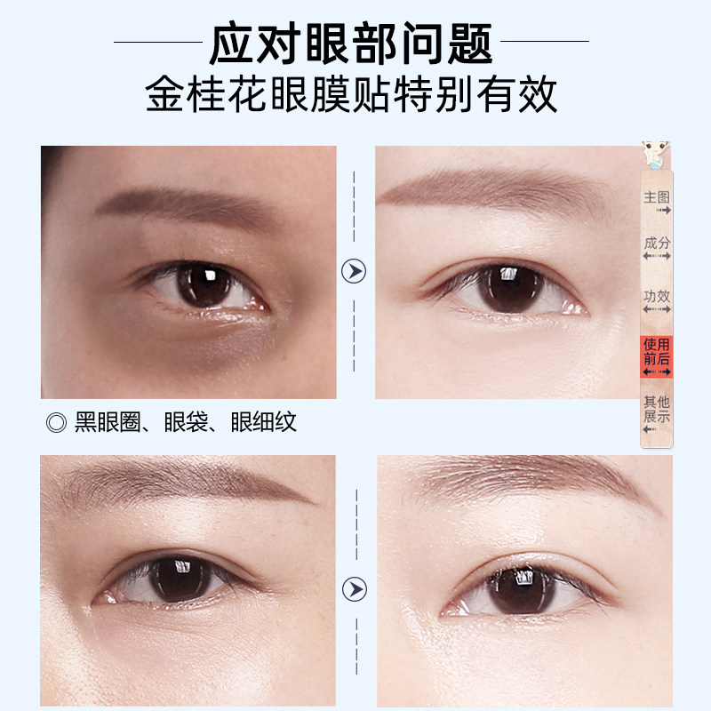 玛茜金桂花淡化细纹去黑眼圈眼膜贴 玛茜眼膜