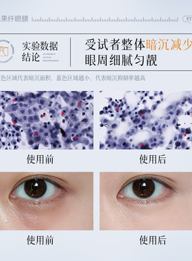 玛茜果纤眼膜贴水润饱满柔滑弹嫩