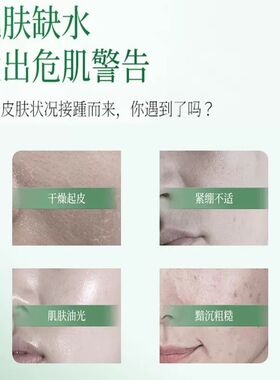 芦荟面膜补水保湿嫩白紧致舒缓修复红血丝淡化痘印官方旗舰店正品