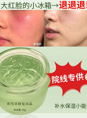 敏感肌舒缓退红修复冰晶补水保湿
