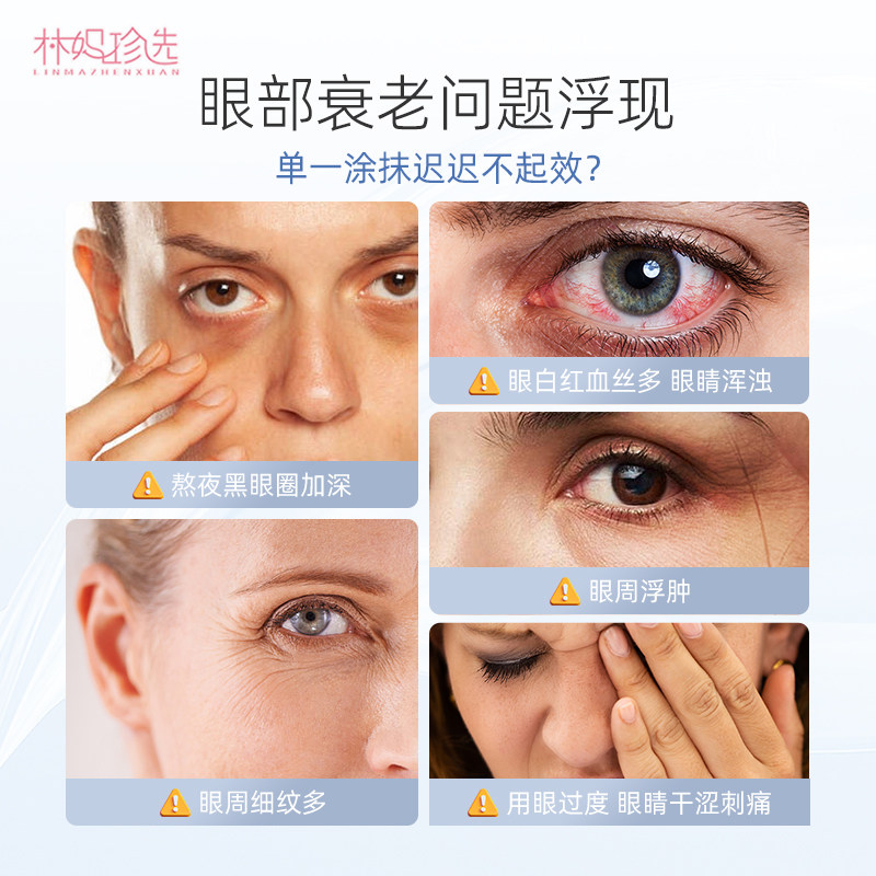 Beyondnature蓓养乐眼回春胶囊 越橘叶黄素青少年眼睛视力保护,淘宝优惠券,粉丝福利购,淘宝优惠卷