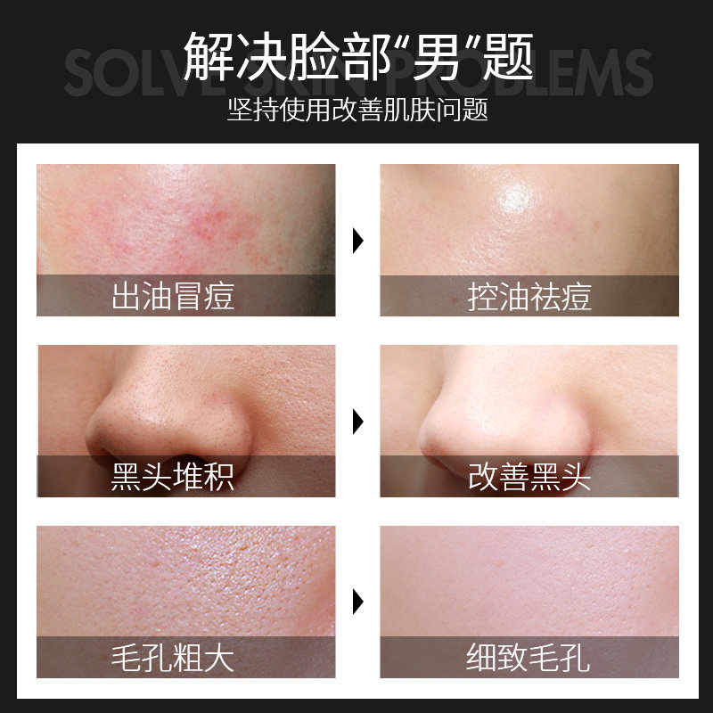 采诗男士深层清洁毛孔补水洗面奶 采诗男士洁面