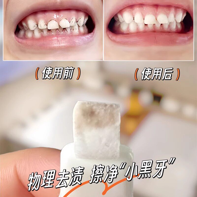美白牙齿橡皮擦洁牙海绵儿童牙菌斑祛除神器快速去牙黑渍牙黄牙刷