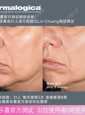 德美乐嘉塑颜精华提拉紧致塑形
