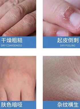 隆力奇蛇油膏护手霜正品