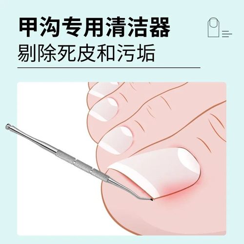 甲沟炎神器指甲矫正器嵌甲专用隔离填充垫片脚趾甲往肉里长纠正甲 - 图2