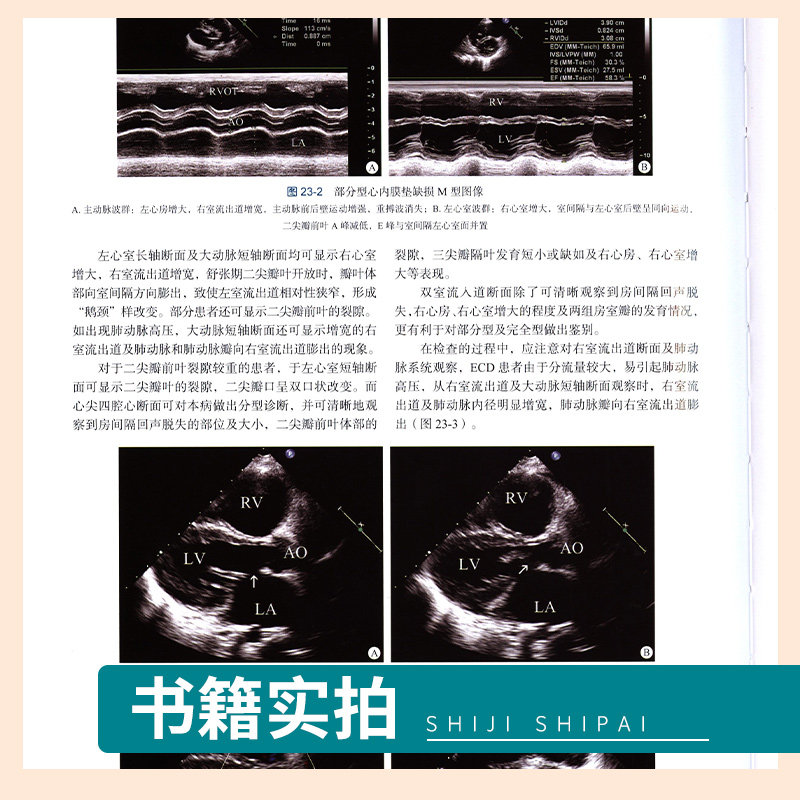 正版 临床超声心动图学 第四版第4版 刘延玲 熊鉴然 心动图手册解读入门影像心超笔记心血管心脏彩超书图谱实用指南书籍
