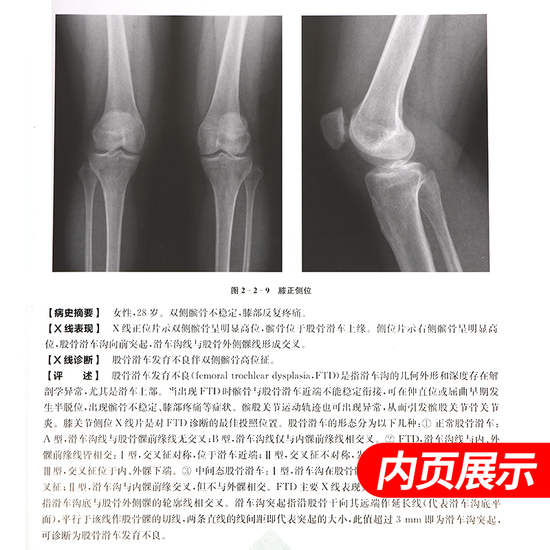 正版 X线读片指南 第4版 第四版医学检查鉴别放射诊断学系列图谱邢伟邱建国精装实用临床影像诊断报告丛书籍X光江苏凤凰科技出版社 - 图2