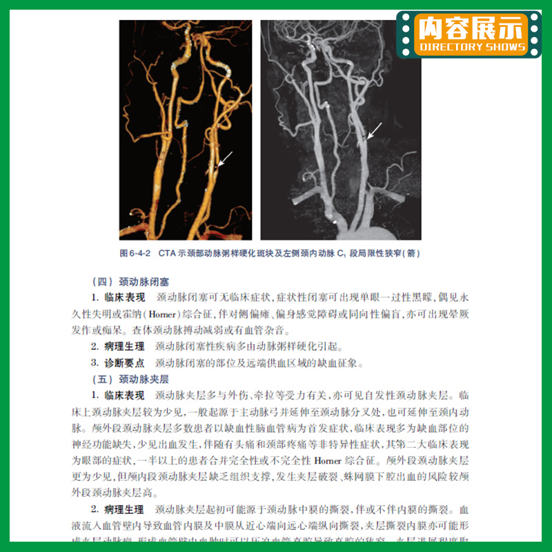 实用CT血管成像技术 多层螺旋CT的成像基础 理论与实践结合 图文并茂 雷子乔 李真林 牛延涛主编 9787117301442 人民卫生出版社