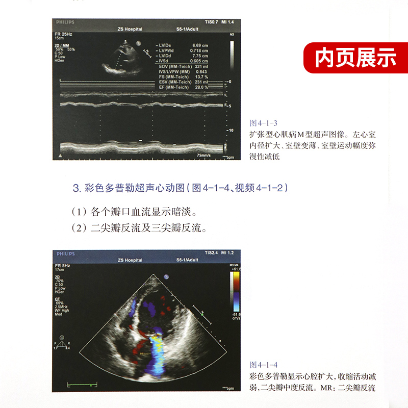 心脏超声入门明明白白学超声心脏超声书图谱超声精细讲解掌中宝诊断学图谱超声心动图胎儿超声医学书籍心电图心血管影像学影像-图2