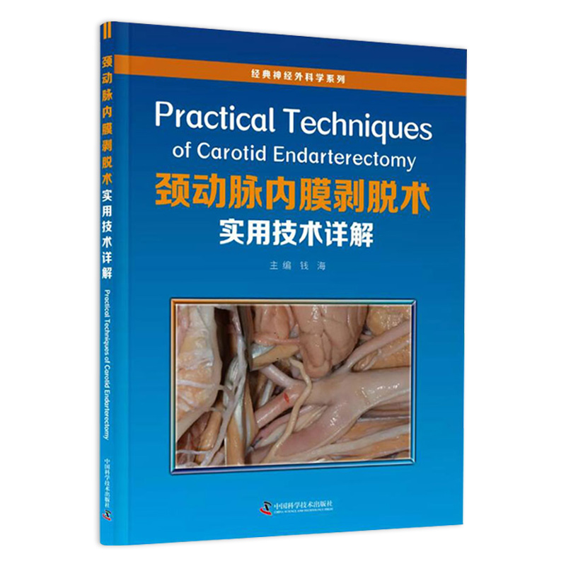 颈动脉内膜剥脱术实用技术详解 9787504687401 钱海 主编 中国科学技术出版社 涵盖了CEA的方方面面 如病例选择 手术时机等 - 图1