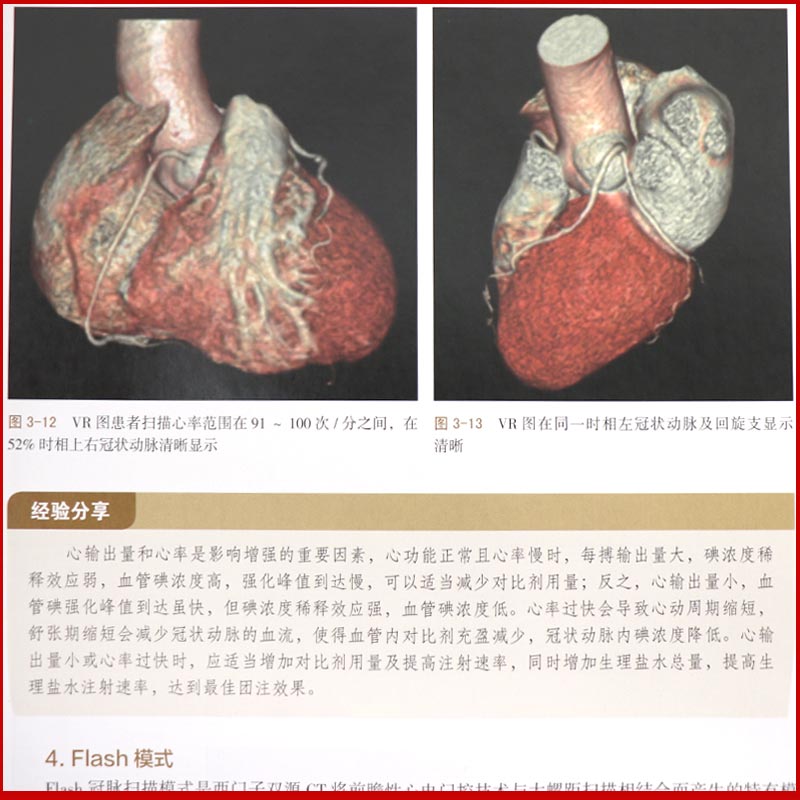 心血管疾病CT扫描技术 陈险峰 李林 马小静 主编 9787117254977 影像医学 2018年5月参考书 人民卫生出版社 - 图2